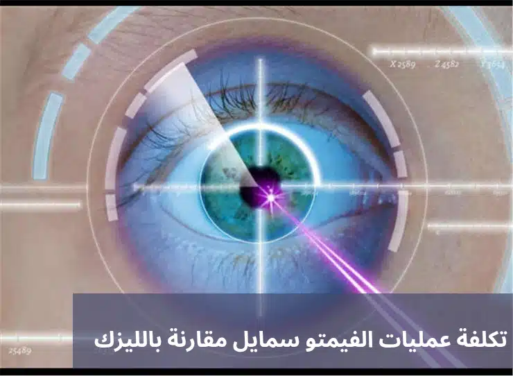 1000334371 تكلفة عمليات الفيمتو سمايل مقارنة بالليزك