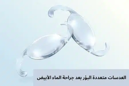 1000334789 العدسات متعددة البؤر بعد جراحة الماء الأبيض