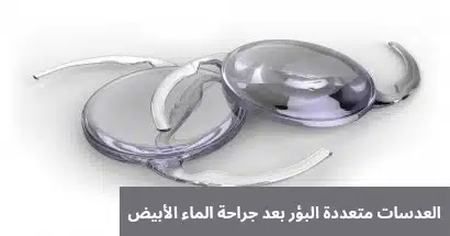 العدسات متعددة البؤر بعد جراحة الماء الأبيض
