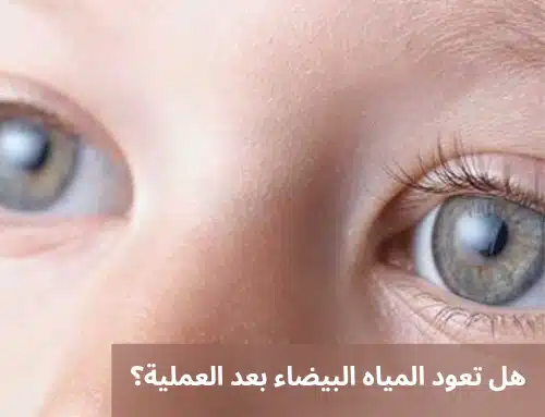 1000336344 هل تعود المياه البيضاء بعد العملية؟