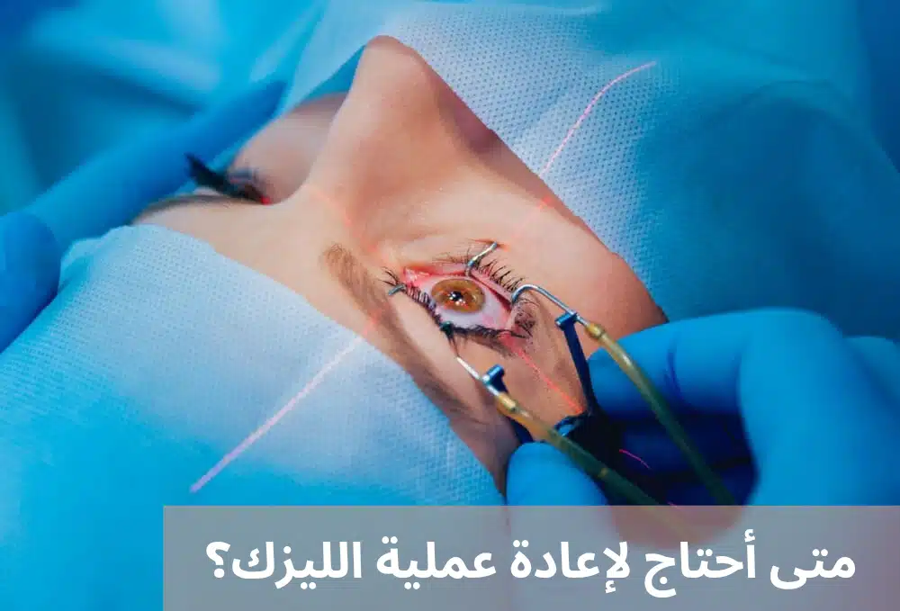 متى أحتاج لإعادة عملية الليزك؟
