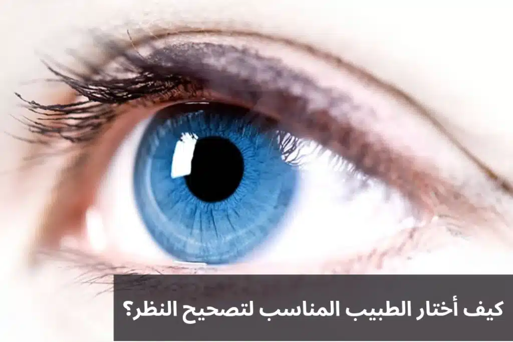 1000339933 كيف أختار الطبيب المناسب لتصحيح النظر؟