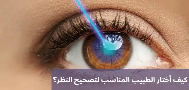 1000339934 كيف أختار الطبيب المناسب لتصحيح النظر؟