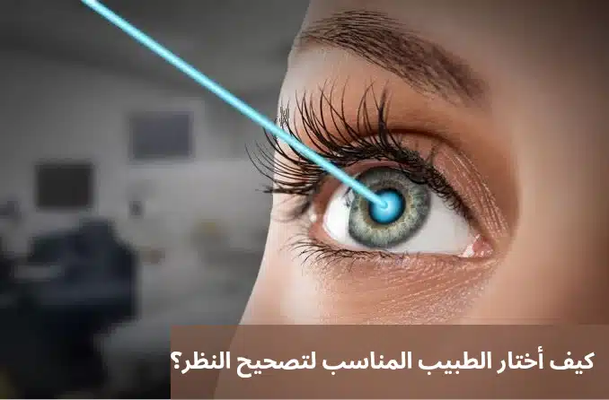 كيف أختار الطبيب المناسب لتصحيح النظر؟

