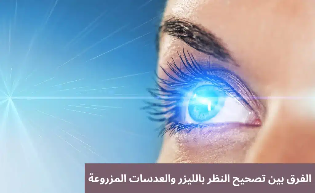 1000341225 الفرق بين تصحيح النظر بالليزر والعدسات المزروعة