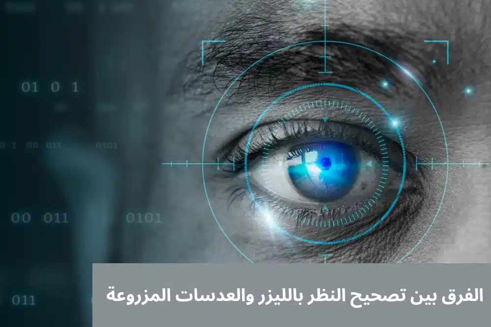 الفرق بين تصحيح النظر بالليزر والعدسات المزروعة

