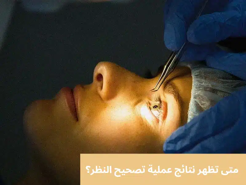 1000341735 متى تظهر نتائج عملية تصحيح النظر؟