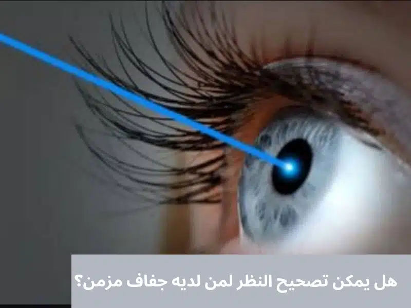 1000342304 هل يمكن تصحيح النظر لمن لديه جفاف مزمن؟