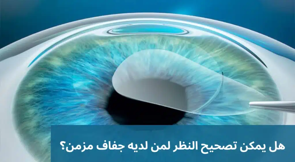 هل يمكن تصحيح النظر لمن لديه جفاف مزمن؟
