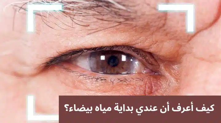 1000345390 كيف أعرف أن عندي بداية مياه بيضاء؟