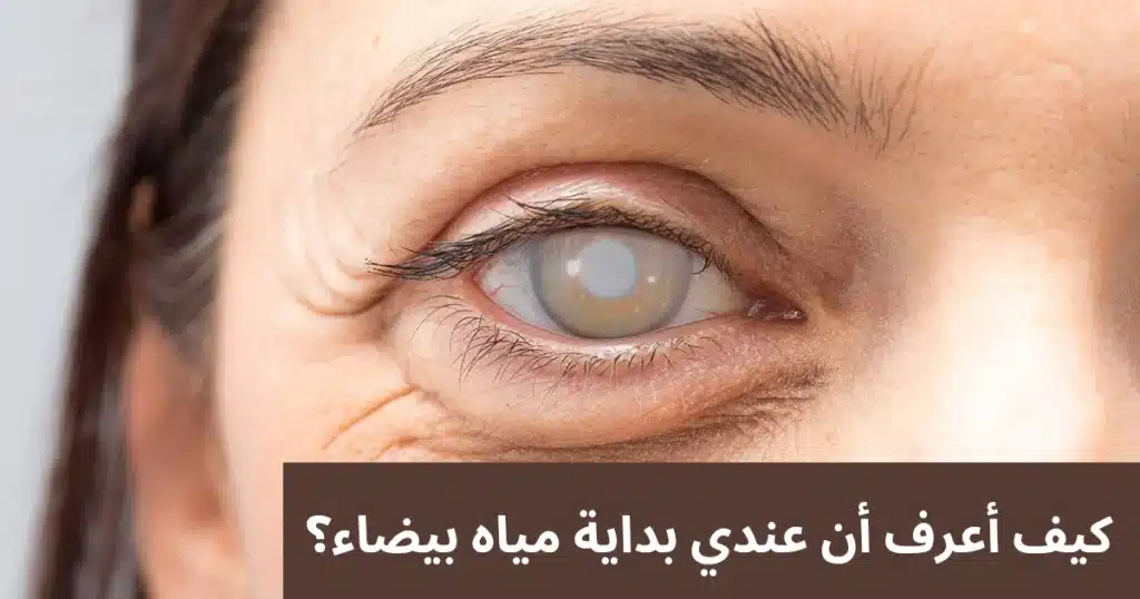 1000345391 كيف أعرف أن عندي بداية مياه بيضاء؟