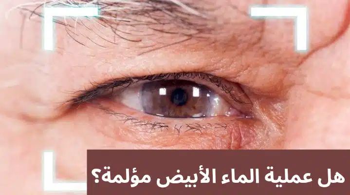 هل عملية الماء الأبيض مؤلمة؟
