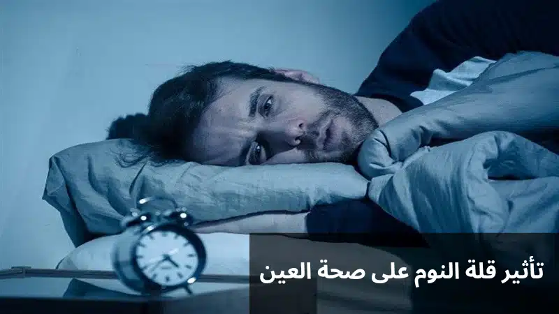 1000347557 تأثير قلة النوم على صحة العين