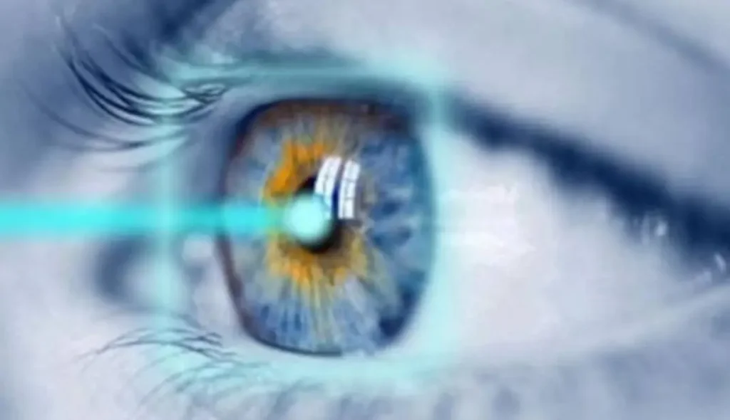 تصحيح النظر للرياضيين
