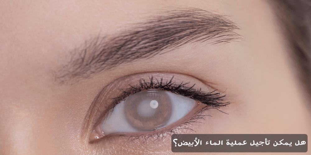 1000345651 هل يمكن تأجيل عملية الماء الأبيض؟