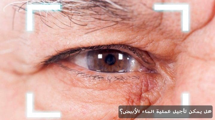 1000346557 هل يمكن تأجيل عملية الماء الأبيض؟