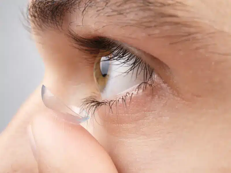 العدسات اللاصقة بعد عملية الليزك
