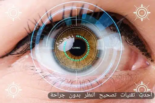 1000349777 أحدث تقنيات تصحيح النظر بدون جراحة