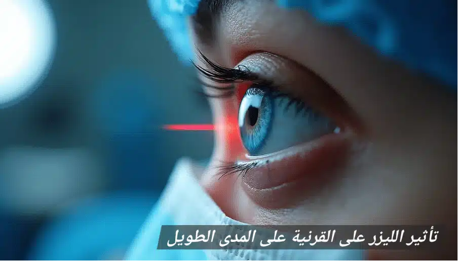 1000357006 تأثير الليزر على القرنية على المدى الطويل