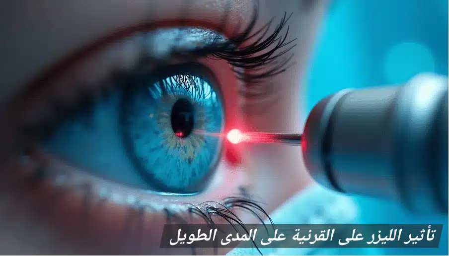 1000357007 تأثير الليزر على القرنية على المدى الطويل