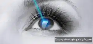 1000359032 المدونة