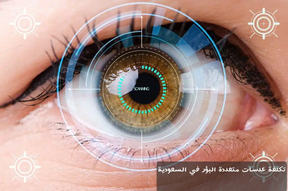 1000363597 تكلفة عدسات متعددة البؤر في السعودية