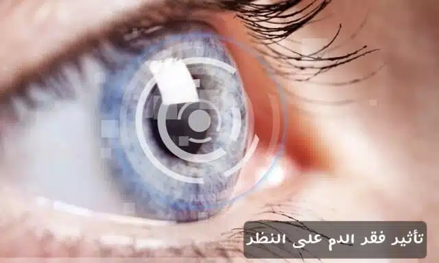 1000366658 تأثير فقر الدم على النظر