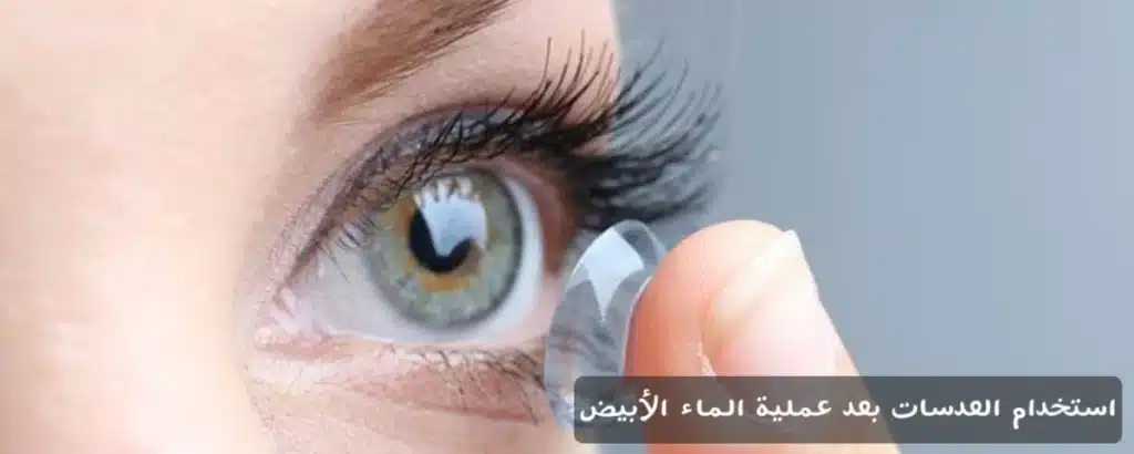 استخدام العدسات بعد عملية الماء الأبيض

