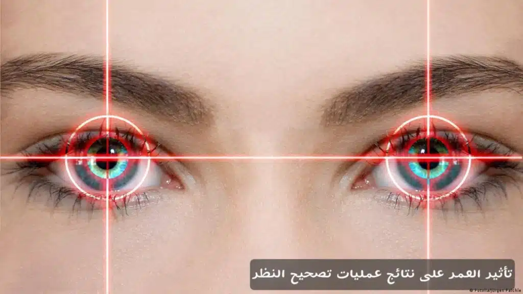 1000370564 تأثير العمر على نتائج عمليات تصحيح النظر