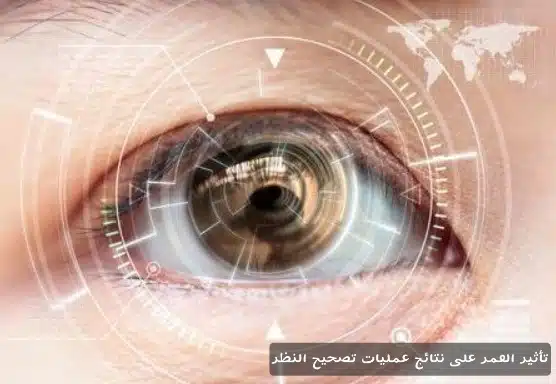 تأثير العمر على نتائج عمليات تصحيح النظر