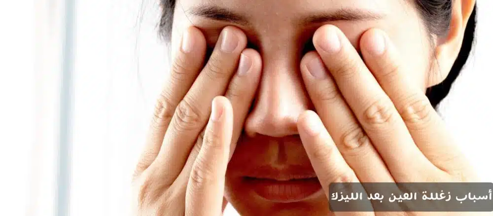 1000376912 أسباب زغللة العين بعد الليزك