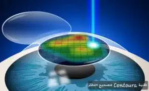 1000377393 المدونة