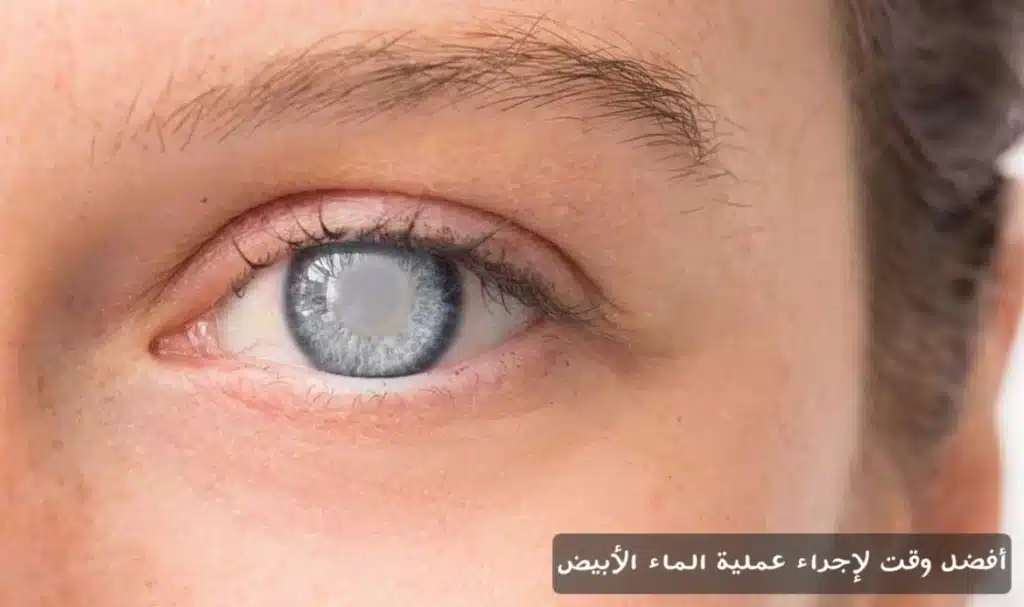 1000379567 أفضل وقت لإجراء عملية الماء الأبيض