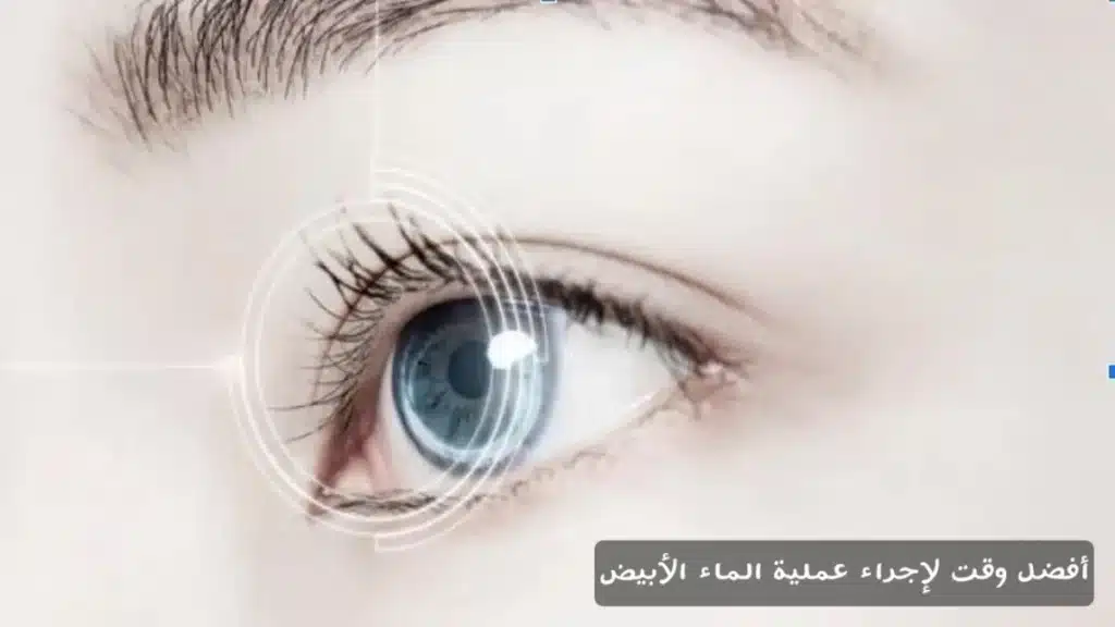 أفضل وقت لإجراء عملية الماء الأبيض
