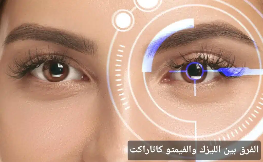 1000394830 الفرق بين الليزك والفيمتو كاتاراكت