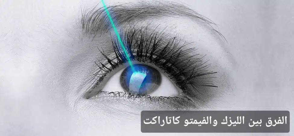 الفرق بين الليزك والفيمتو كاتاراكت