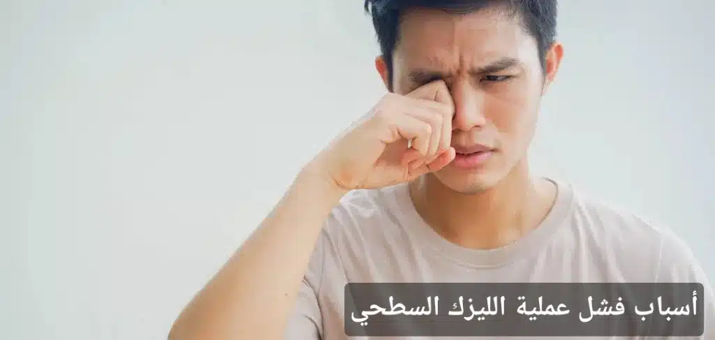 1000405676 أسباب فشل عملية الليزك السطحي