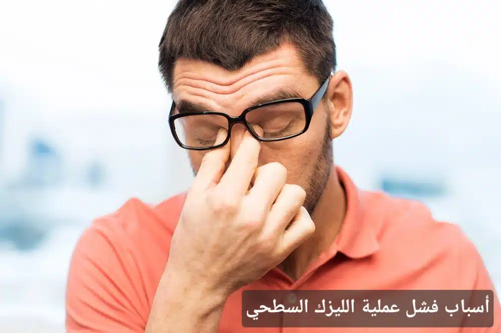 أسباب فشل عملية الليزك السطحي