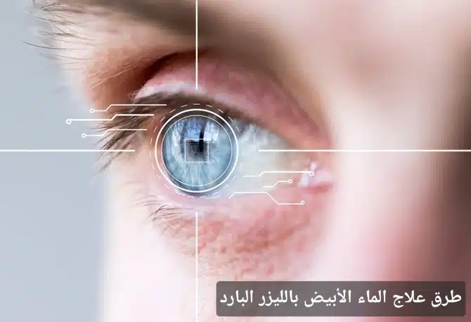 1000407494 1 طرق علاج الماء الأبيض بالليزر البارد