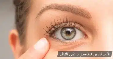 1000409295 تأثير نقص فيتامين د على النظر