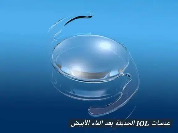 1000412794 عدسات IOL الحديثة بعد الماء الأبيض