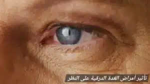 1000418642 المدونة