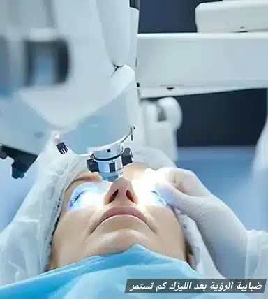 ضبابية الرؤية بعد الليزك كم تستمر

