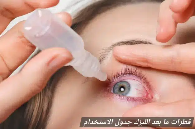 1000427767 قطرات ما بعد الليزك جدول الاستخدام