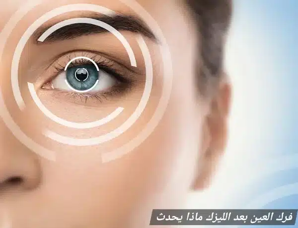 1000429274 فرك العين بعد الليزك ماذا يحدث