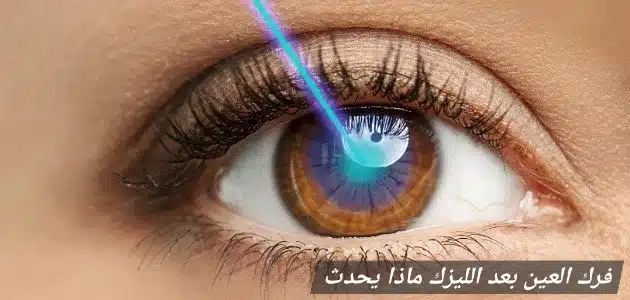 فرك العين بعد الليزك ماذا يحدث
