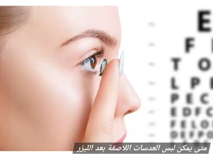 1000431150 متى يمكن لبس العدسات اللاصقة بعد الليزر