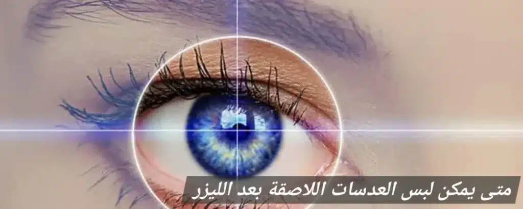 1000431151 متى يمكن لبس العدسات اللاصقة بعد الليزر