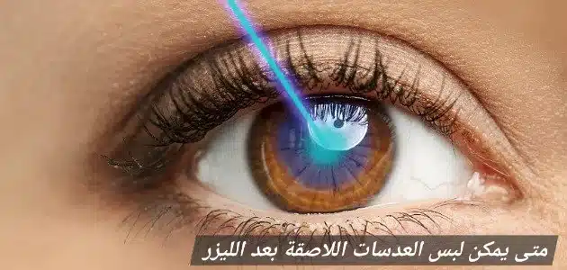 متى يمكن لبس العدسات اللاصقة بعد الليزر