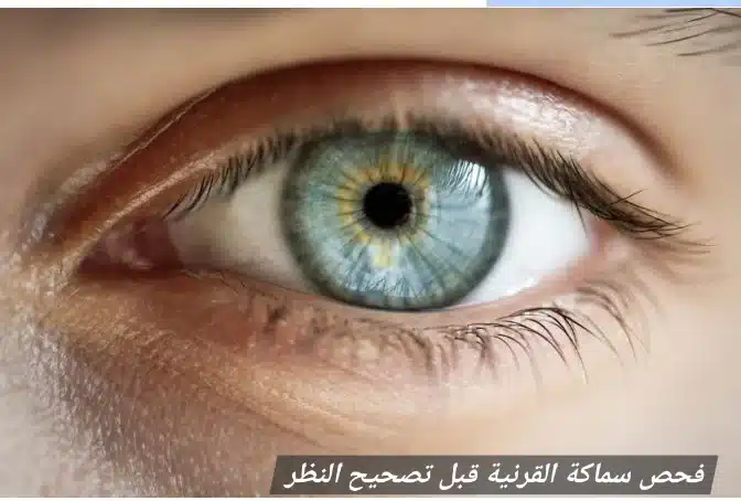 1000437334 فحص سماكة القرنية قبل تصحيح النظر